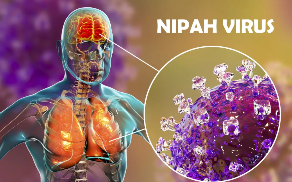 Waspada Ancaman Virus Nipah